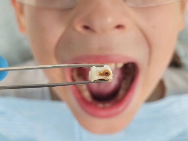Best Tooth Pain Emergency Relief  in Shiloh, PA